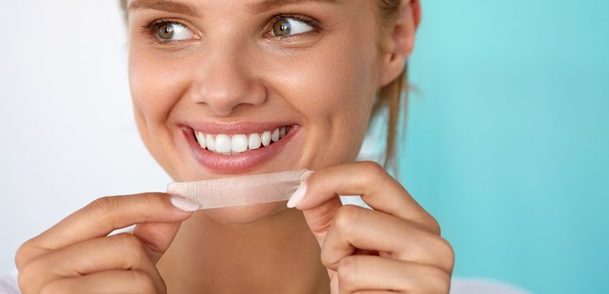 teeth whitening charlotte