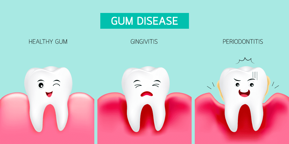 gum disease treatment