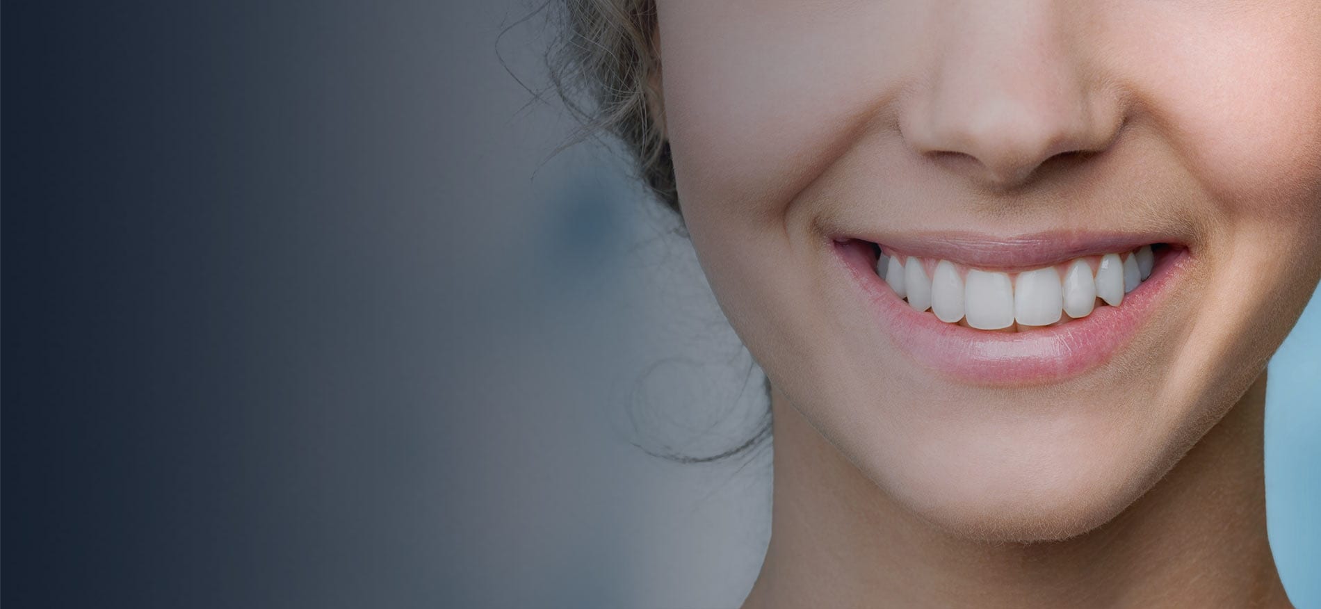 Teeth Whitening Ottawa