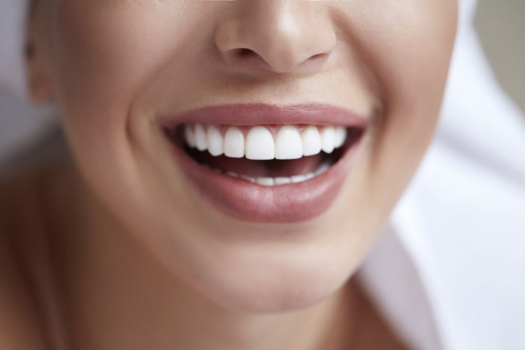 Teeth Whitening Ottawa