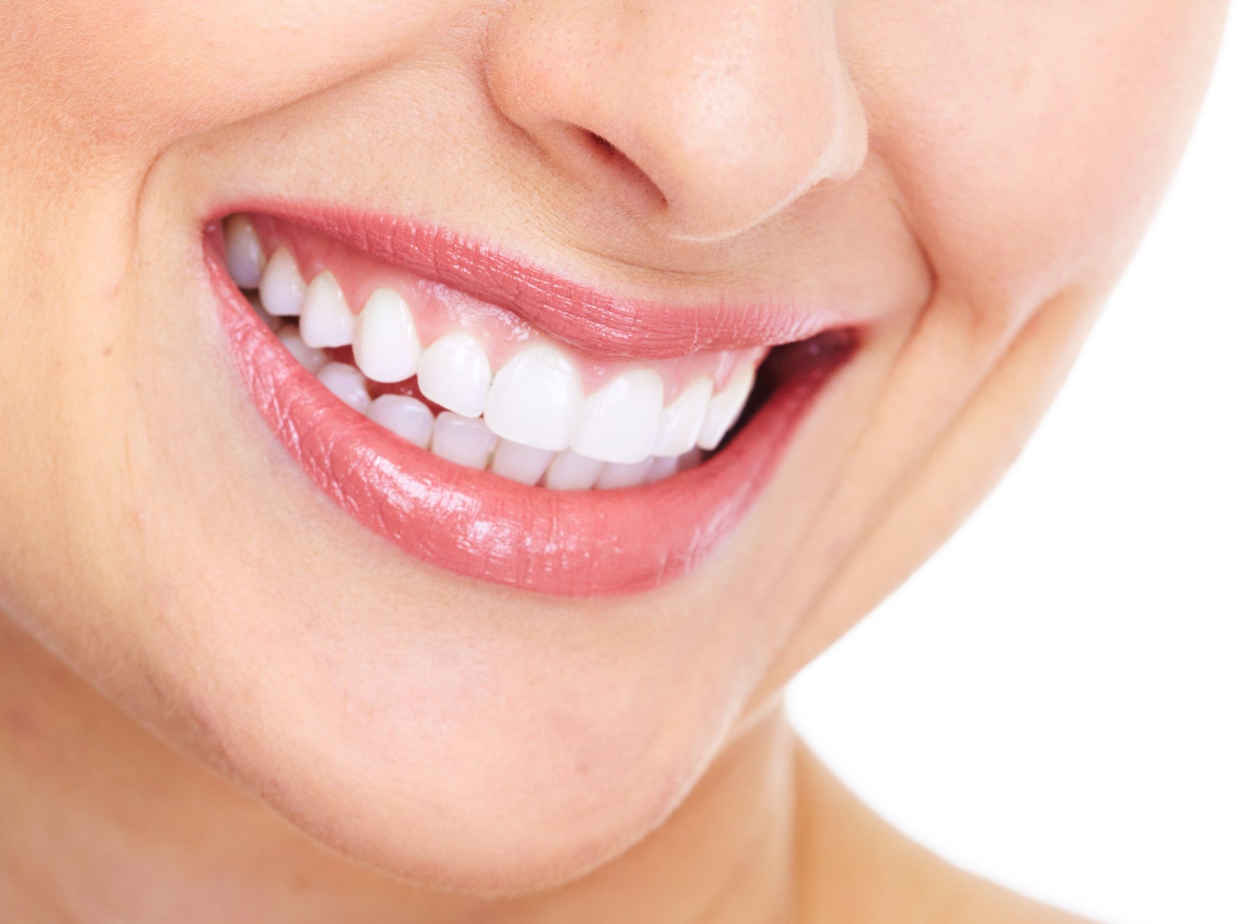 teeth whitening Gold Coast