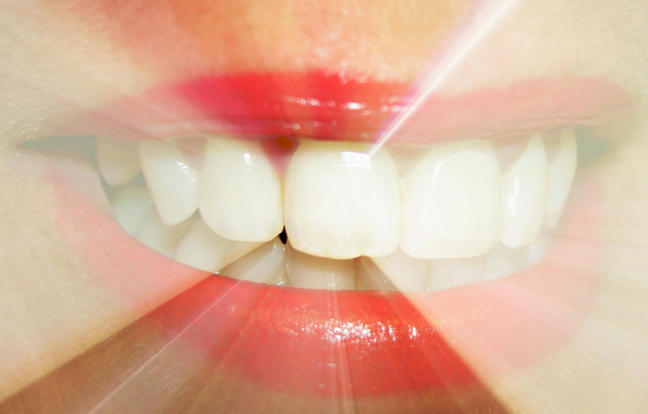 Professional dental cleanings