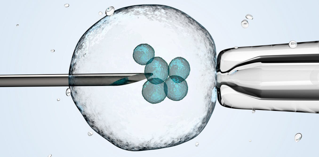 IVF cost in South Africa
