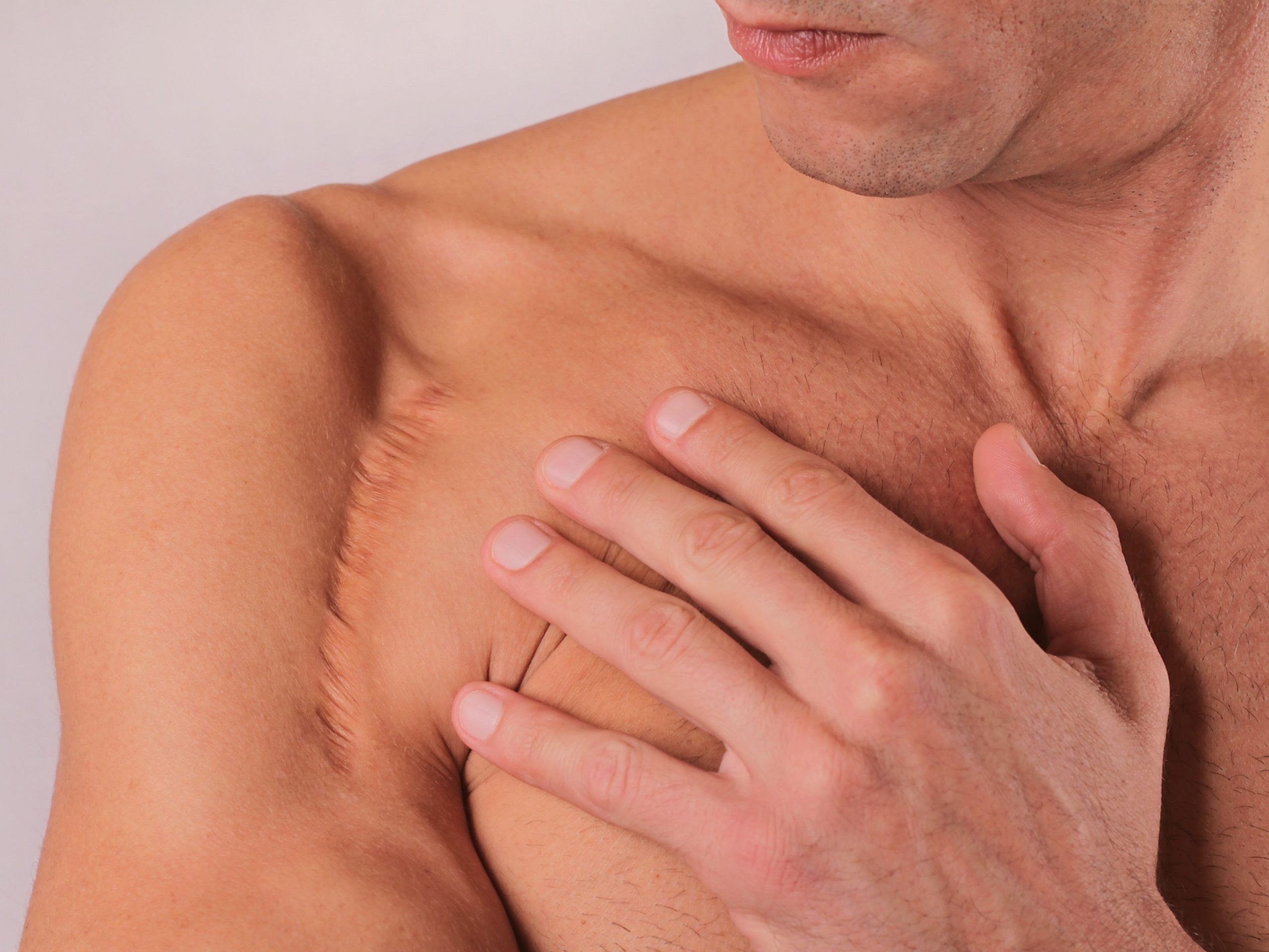 massaging a scar