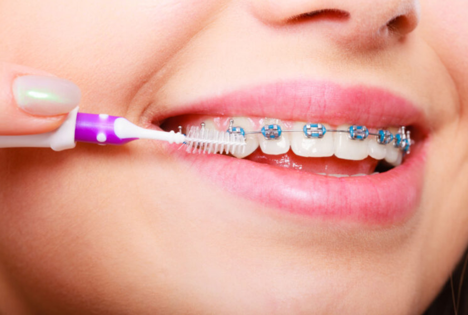 orthodontist treatment in Victoria