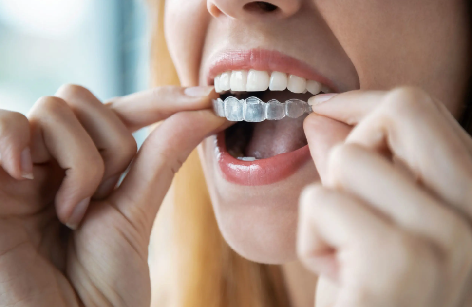 snore mouthguard from the UK