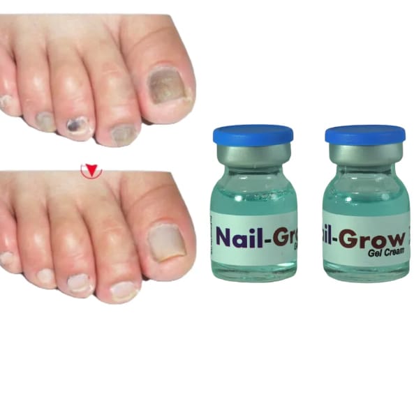 Nail-Fix antifungal treatment