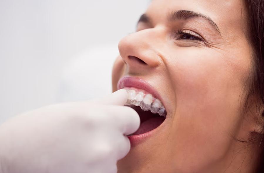 invisalign treatment